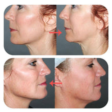 Load image into Gallery viewer, Hirundo Face Lifting Patch Invisible Artifact Sticker
